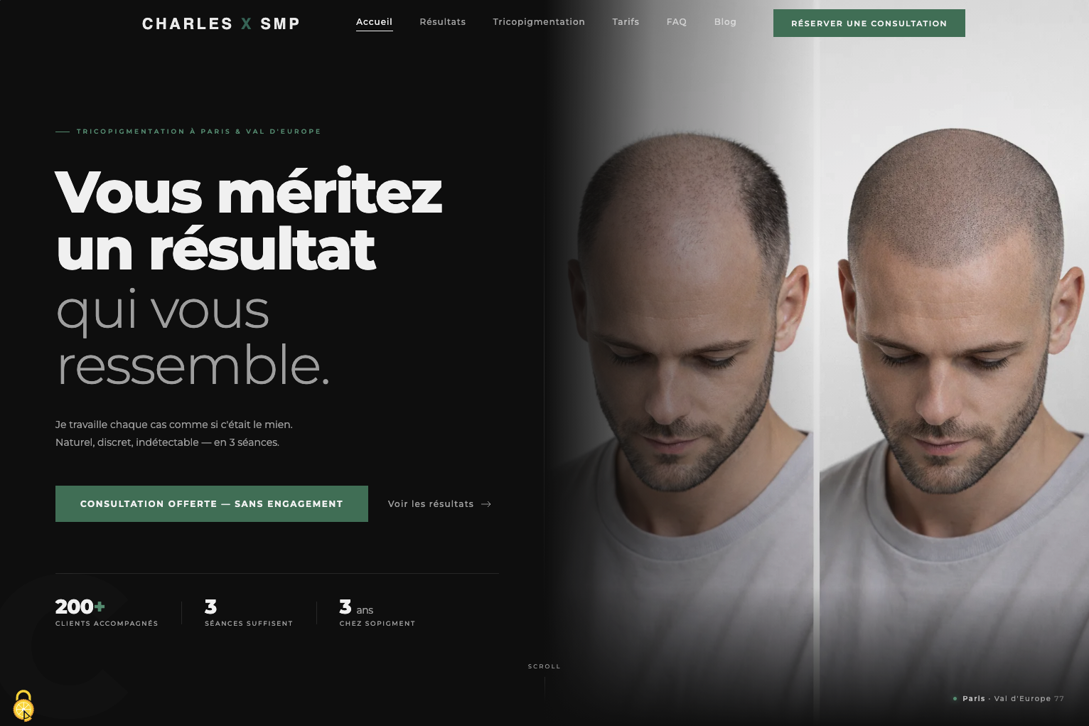 Site vitrine tricopigmentation — Charles × SMP